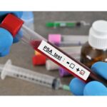 Blood vial for PSA test